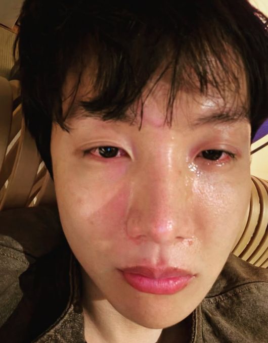 Close‑up of J‑Hope’s tearful face with red eyes and flushed cheeks under warm lighting.